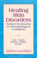 Healing skin disorders : natural treatments for dermatological conditions : acne, eczema, psoriasis, shingles, and more