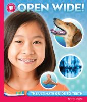 Open wide! : the ultimate guide to teeth
